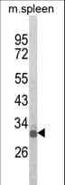 IHC-plus™ OLIG3 Antibody (aa74-100)
