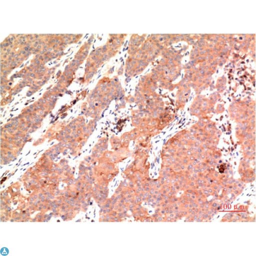TUBE1 / Tubulin Epsilon Antibody