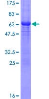 Human CCNH / Cyclin H Protein (Recombinant GST)