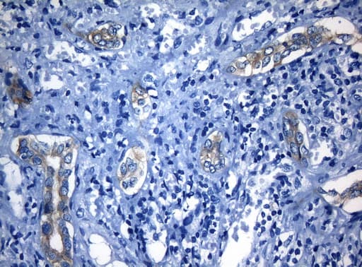 RAB3IP / RABIN3 Antibody (clone OTI5F2)
