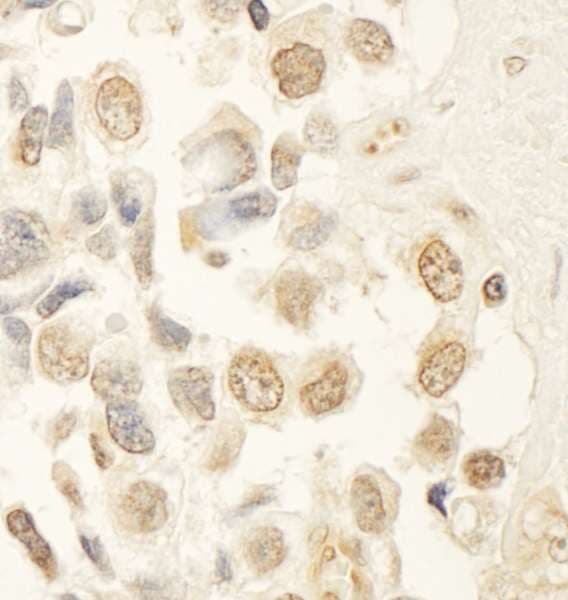 MYST2 / HBO1 Antibody (aa125-175)