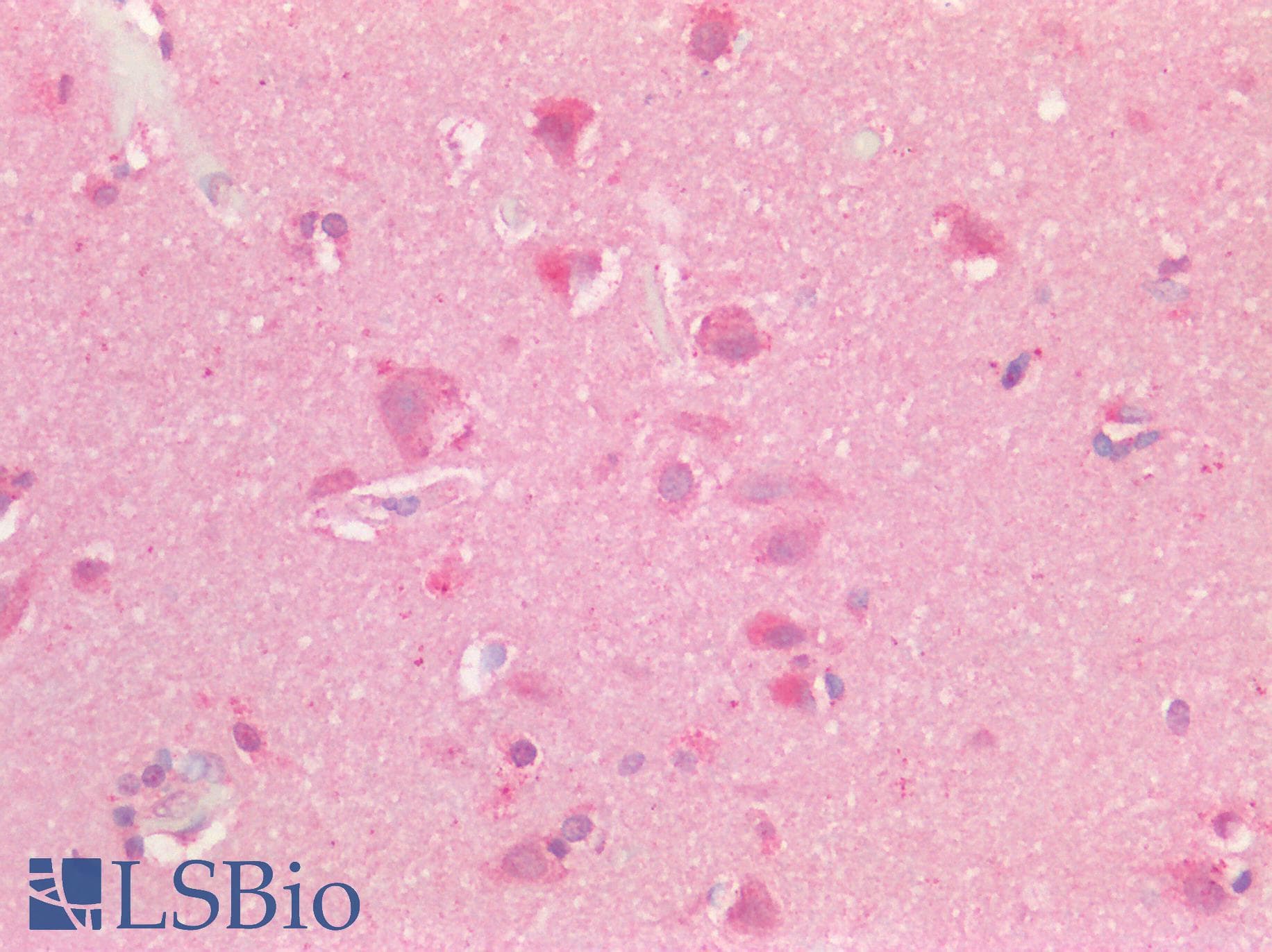 Polyclonal Rabbit anti-Human HS2ST1 Antibody (aa252-301, IHC, WB)