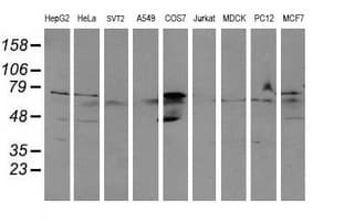 ALDH3A2 Antibody (clone OTI2D3)