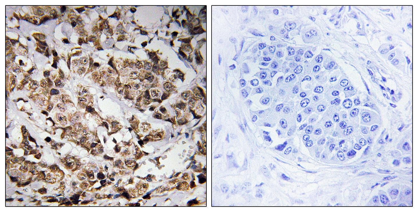 Polyclonal Rabbit anti-Human RAB2A / RAB2 Antibody (IHC, WB)
