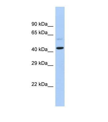 SLC16A7 / MCT2 Antibody (aa293-342)