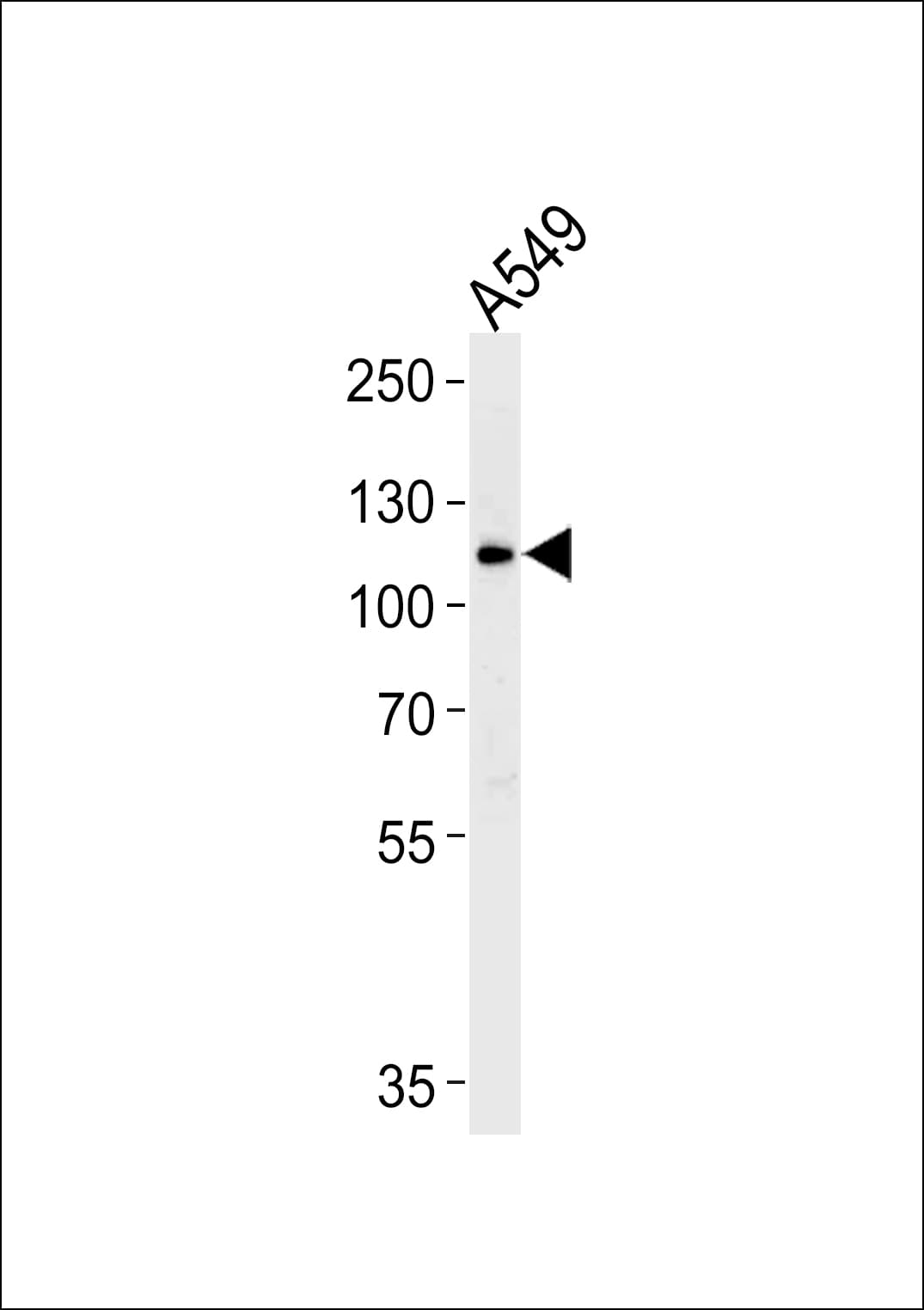 Polyclonal Rabbit anti-Human BICC1 Antibody (aa75-107, WB)