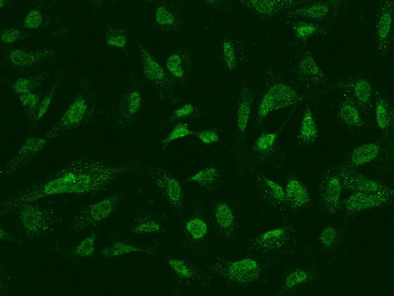 BIRC3 / cIAP2 Antibody