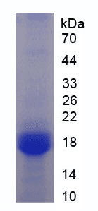 Human CFHR3 / CFHL3 Protein (Recombinant His-GST, N-terminus)
