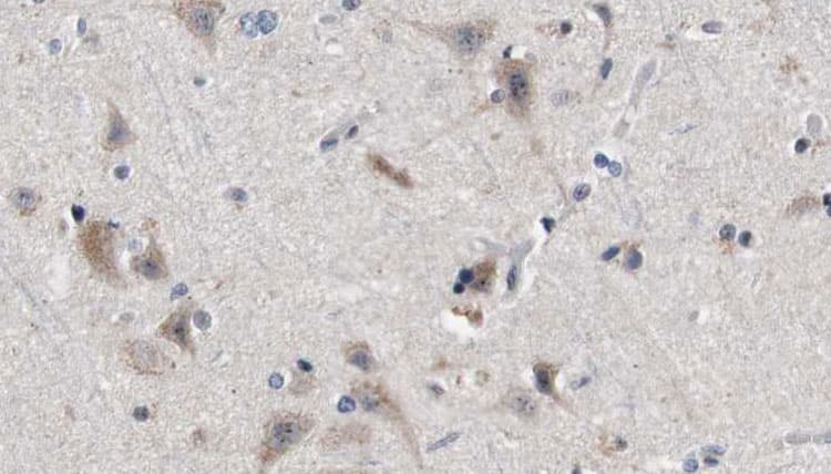 Polyclonal Rabbit anti-Human TG737 / IFT88 Antibody (IHC, WB)