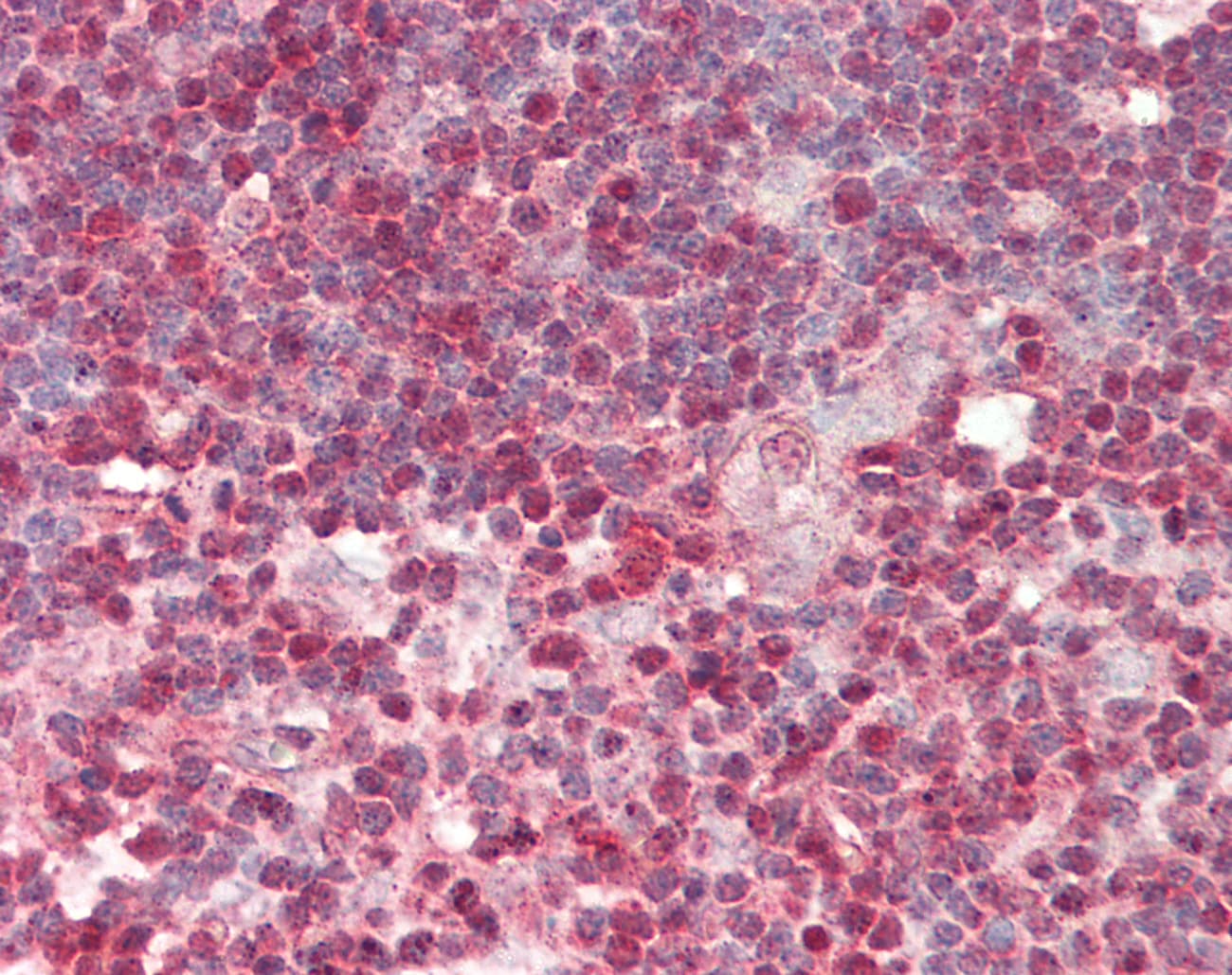 RBBP4 / RBAP48 Antibody (aa71-120)