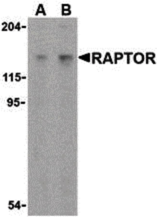 Raptor / Mip1 Antibody