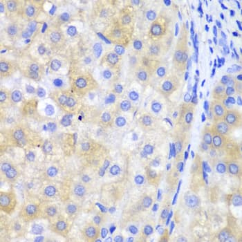 Polyclonal Rabbit anti-Human FTH1 / Ferritin Heavy Chain Antibody (IHC, IF, WB)