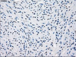 CD32A Antibody (clone OTI20D1)