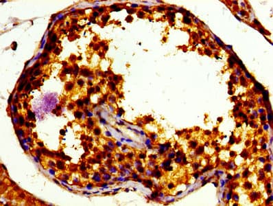 TFE3 Antibody