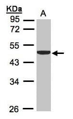 CKB / Creatine Kinase BB Antibody