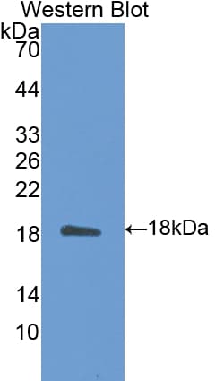 CALM1 / Calmodulin Antibody (aa1-149)