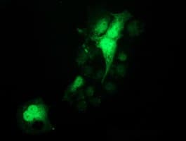 PYCRL Antibody (clone OTI1C11)