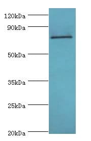 HNRPM / HNRNPM Antibody (aa491-730)