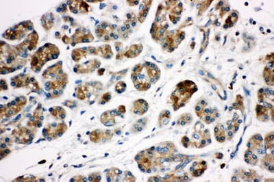 KLK1 / Kallikrein 1 Antibody (aa182-197)