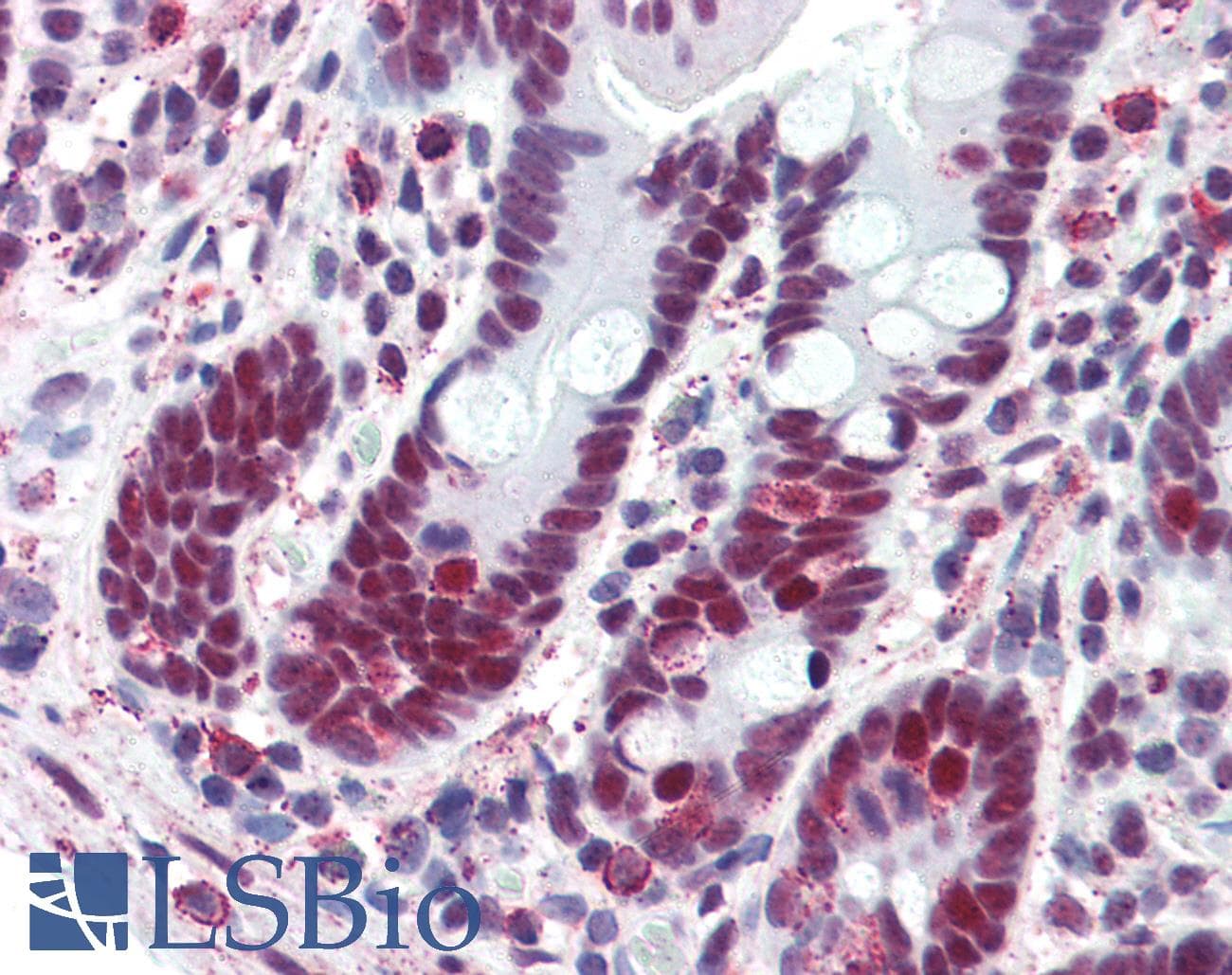 IHC-plus™ GTF2I / TFII I Antibody
