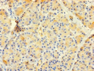 Polyclonal Rabbit anti-Human CTRB1 / Chymotrypsinogen B1 Antibody
