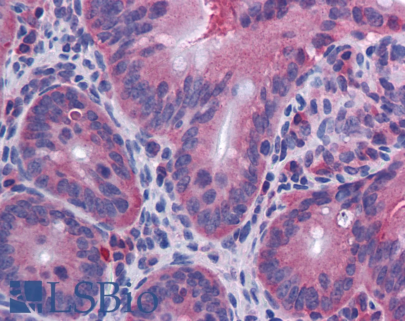 PathPlus™ IL-10 Antibody (clone JES5-2A5)