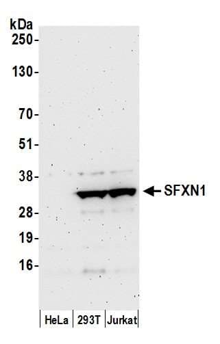 Polyclonal Rabbit anti-Human SFXN1 Antibody (aa1-50, WB)