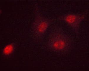 Polyclonal Rabbit anti-Human MYC / c-Myc Antibody (phospho-Ser62, IHC, IF, WB)
