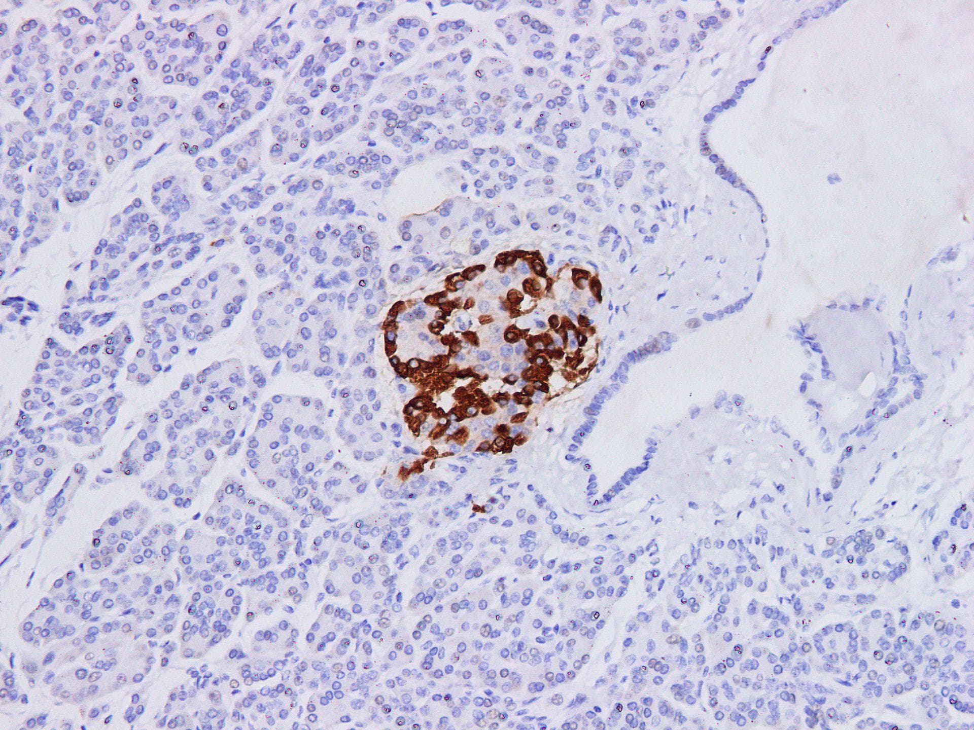 GCG / Glucagon Antibody