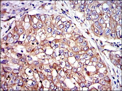 Monoclonal Mouse anti-Human CRK Antibody (clone 3G11E8, IHC, IF, WB)