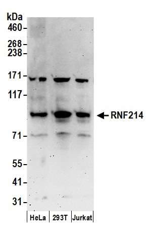 RNF214 Antibody (aa1-50)