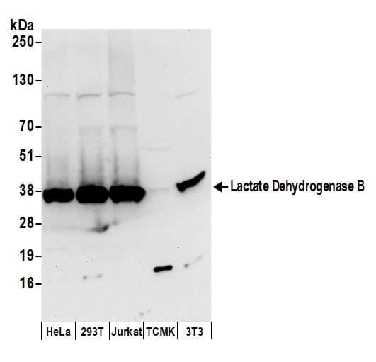 LDHB / Lactate Dehydrogenase B Antibody (aa284-334)