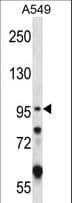 GRIK2 / GLUR6 Antibody (aa828-856)