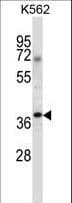 NCK1 / NCK Antibody (aa63-92)