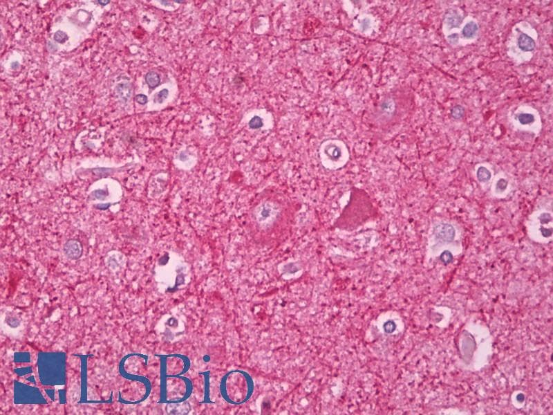 IHC-plus™ APBA1 / MINT1 Antibody