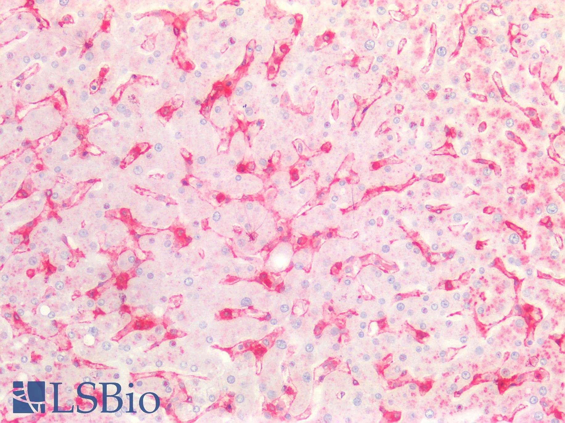 PathPlus™ CAV1 / Caveolin 1 Antibody (C-Terminus)