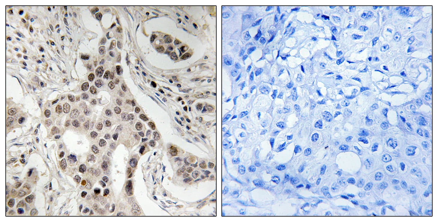 NCOA2 / TIF2 Antibody (phospho-Ser736)