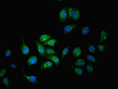 Polyclonal Rabbit anti-Human SERPINA6 / CBG Antibody (aa136-405, IHC)