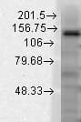 KCNT1 / KCa4.1 Antibody (aa1168-1237, clone S3-26)