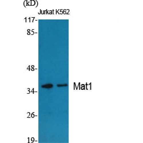 Polyclonal Rabbit anti-Human MNAT1 Antibody (60-140 aa, Internal, IHC, WB)
