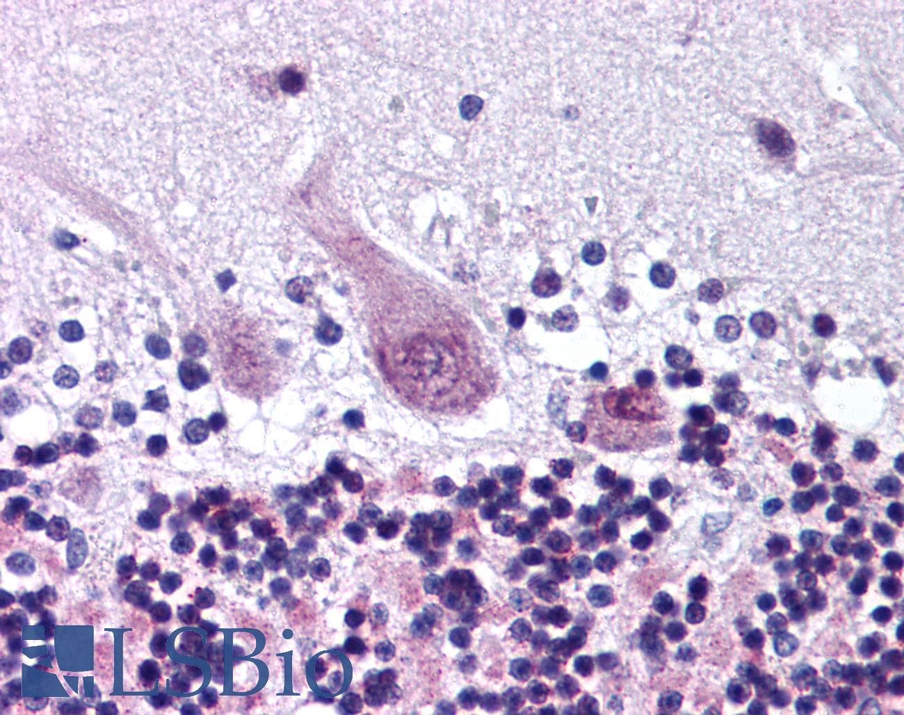 IHC-plus™ ARHGEF10 / GEF10 Antibody (aa1371-1384)