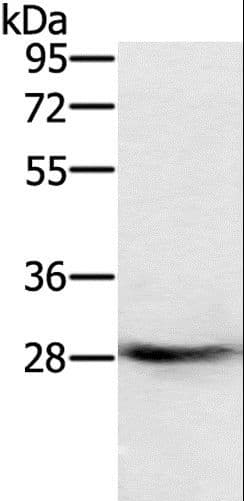 RAB8B Antibody