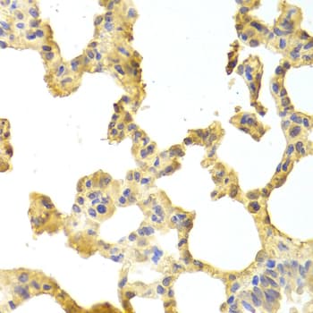 TRAF2 Antibody