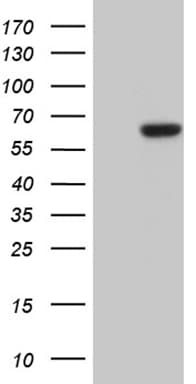 CDY2B Antibody (clone OTI1A10)