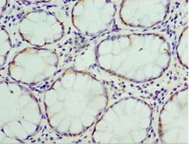 THBS3 / Thrombospondin 3 Antibody (aa787-956)