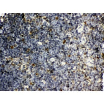 SNRPN Antibody (aa11-39)