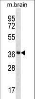 PRKACA + PRKACB Antibody (aa292-319)