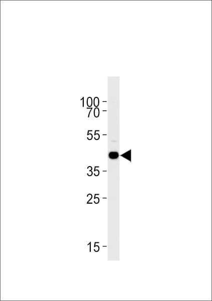 Polyclonal Rabbit anti-Zebrafish S1PR1 / EDG1 / S1P1 Antibody (aa311-335, WB)