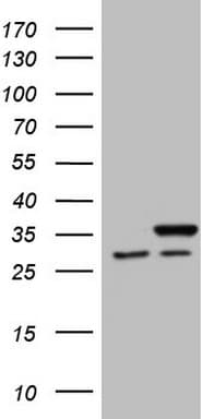 Monoclonal Mouse anti-Human SNRPB2 Antibody (clone OTI1B5, WB)