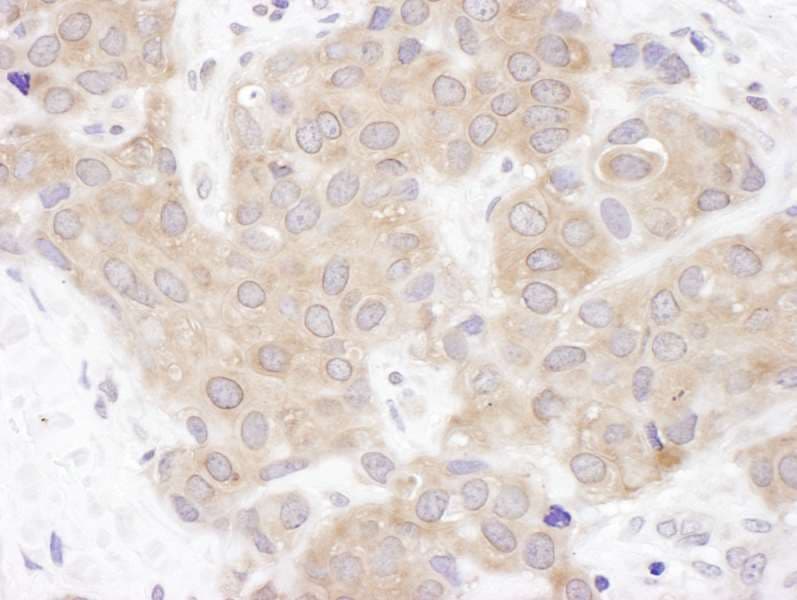 Polyclonal Rabbit anti-Human VCPIP1 Antibody (aa1100-1150, IHC, WB)